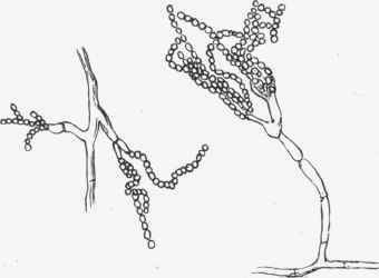 340x250 Ii. Filamentous Fungi Or Moulds