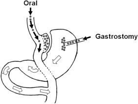 282x212 Schematic Illustration Of Gastrointestinal Glucose Route After
