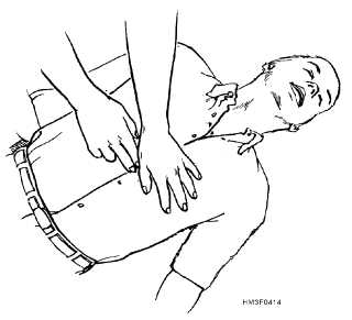 320x291 Chest Compressions