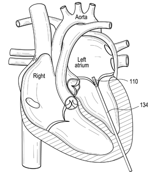 Heart Disease Drawing at GetDrawings | Free download