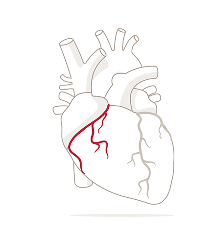 435x480 Heart Disease