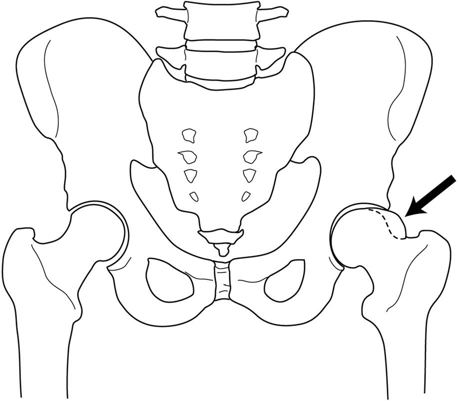 The best free Knee drawing images. Download from 115 free drawings of ...