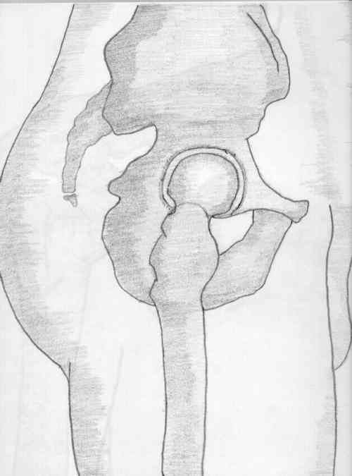 500x675 Wheeless' Textbook Of Orthopaedics