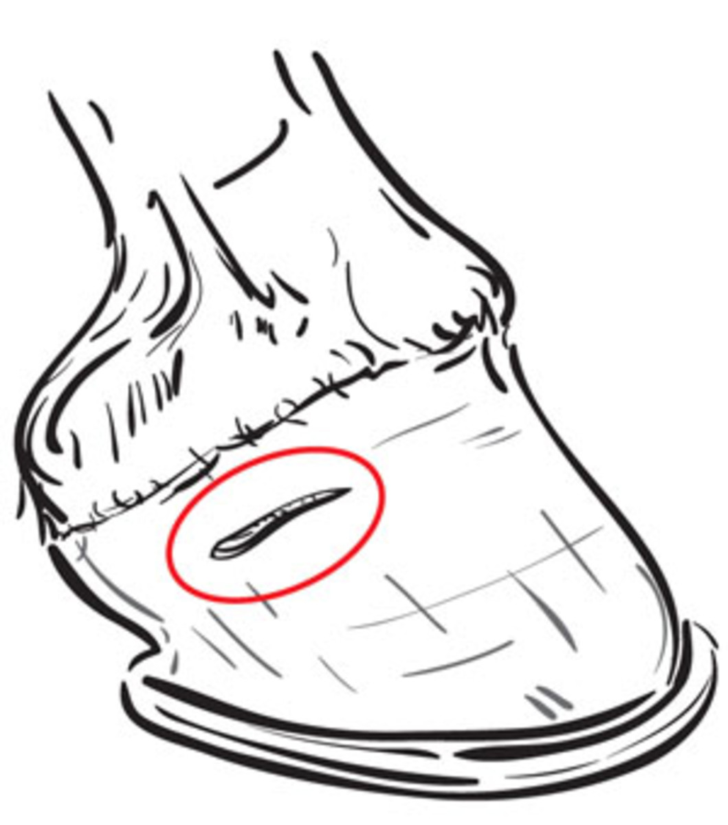 1059x1200 Horizontal Hoof Cracks Demystified