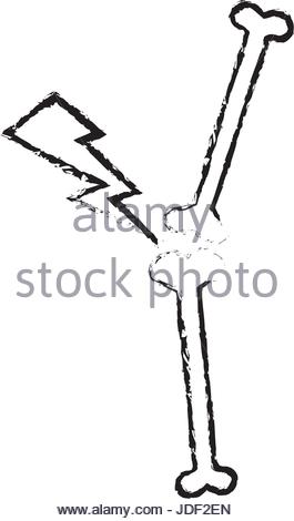 265x470 Drawing Bone Human Pain Anatomical Stock Vector Art Amp Illustration