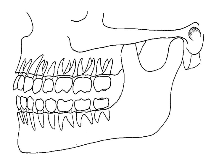 730x560 Position Of Teeth In Jaws