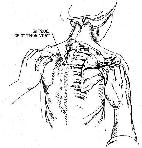 497x518 Bony Palpation Body Diseases