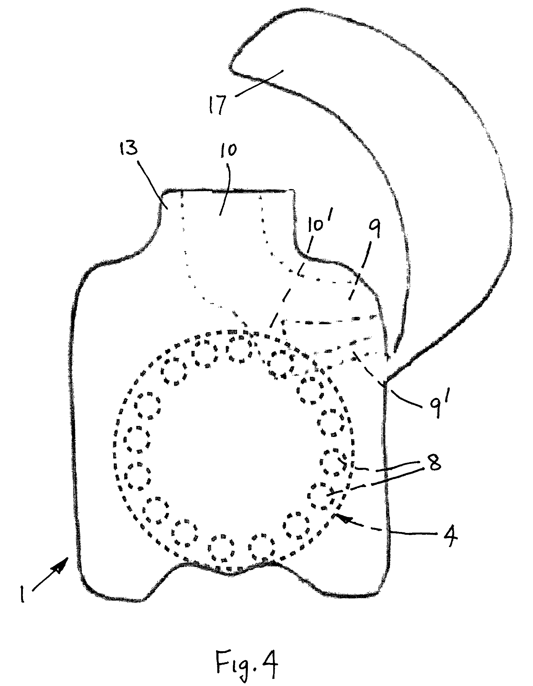 1744x2245 Patent Ep1172122a1