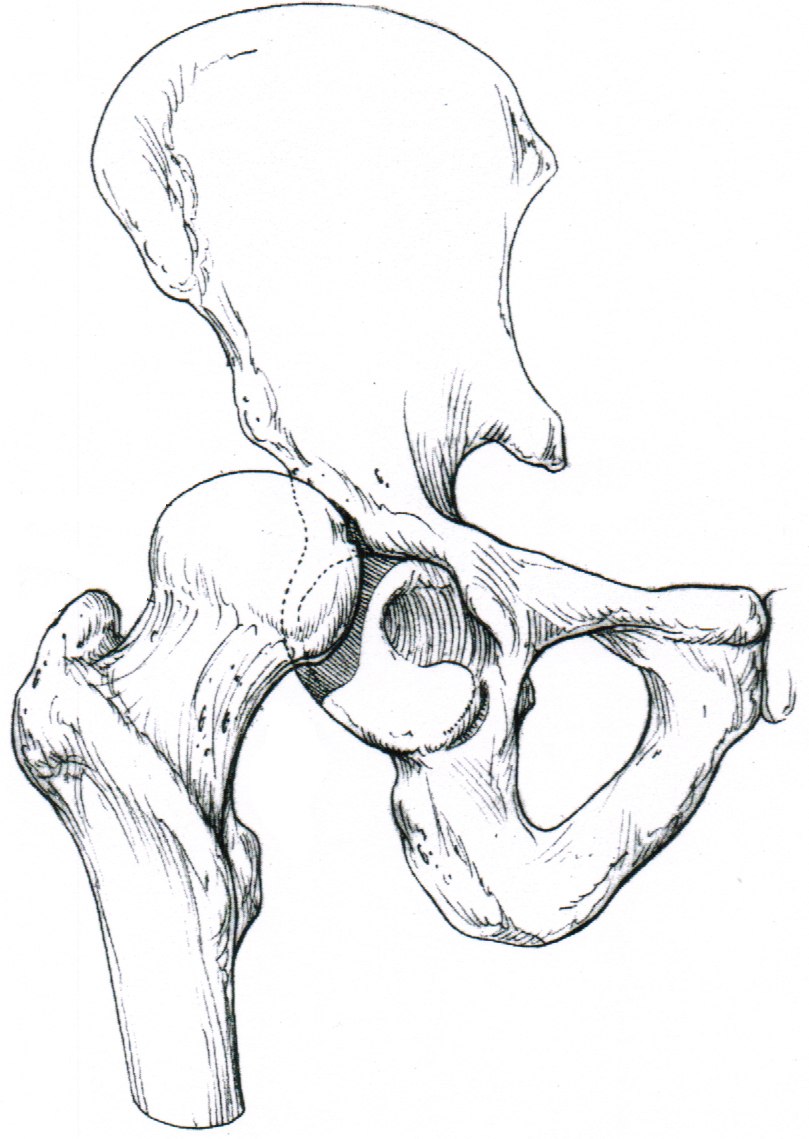 809x1139 Hip Anatomy, Pictures, Function, Problems Amp Treatment