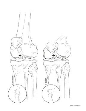 288x373 The Knee In Perspective Hiatus