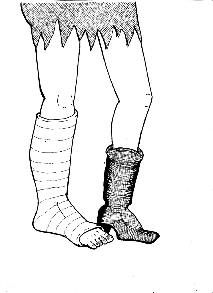 746x1024 The World's Best Photos Of Boot And Cast