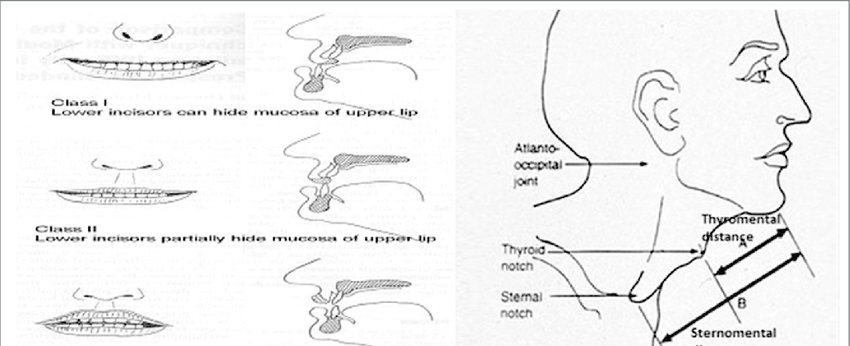 [DIAGRAM] Tick Bitting Diagram - WIRINGSCHEMA.COM