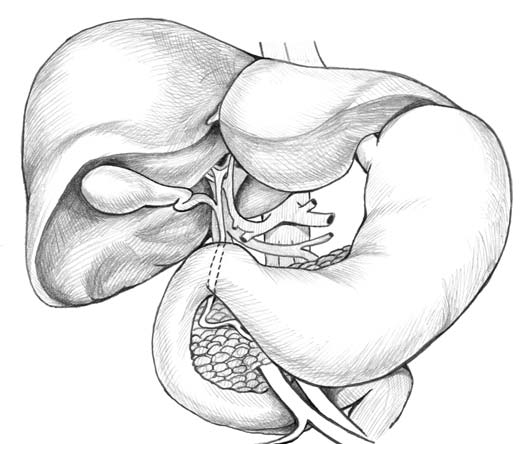 529x461 Liver Clinic Endoscopy Asia