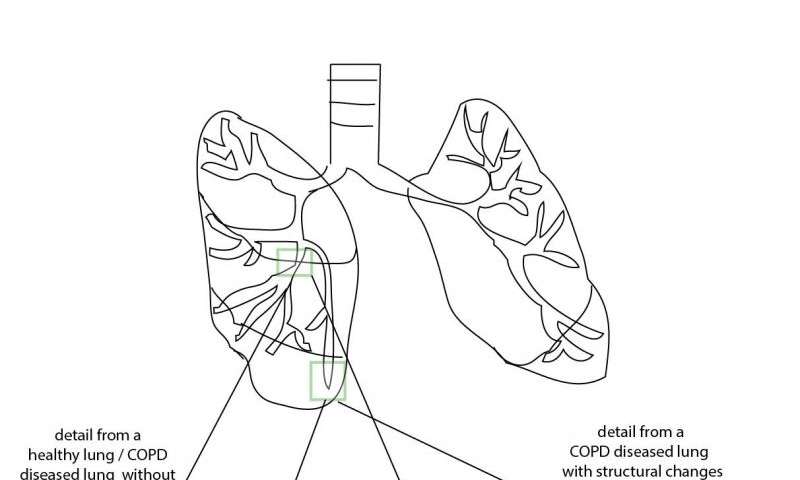 800x480 Changes In The Lungs, Changes In The Microbiome