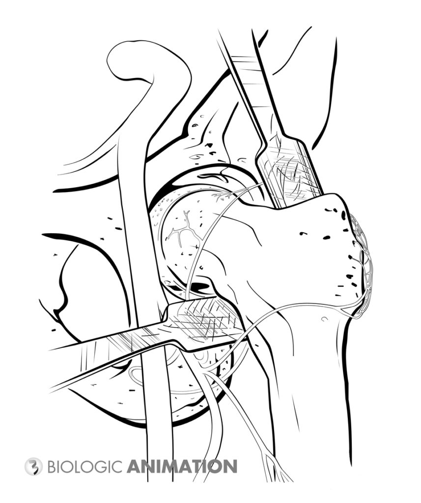 857x1024 Medical Illustration