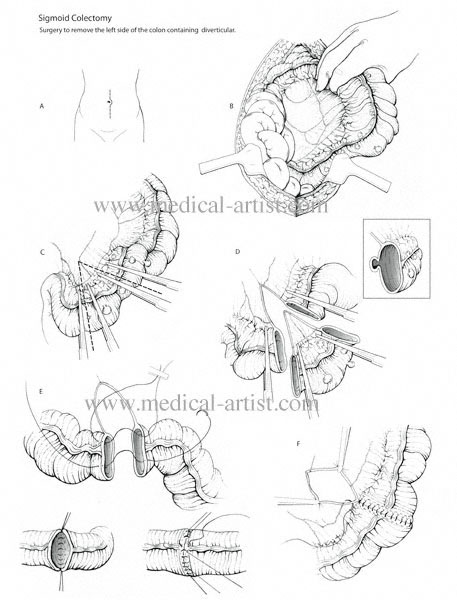 457x600 Traditional Pen And Ink Medical Illustrations Gallery Hand Draw