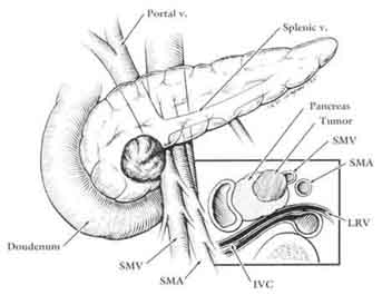 343x274 Body Medical Drawings