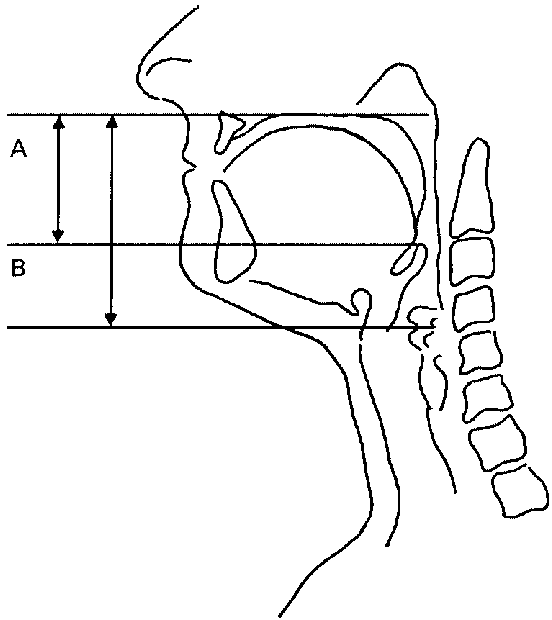 552x620 Typical Saggital Section Mri From Which The Following Measurements