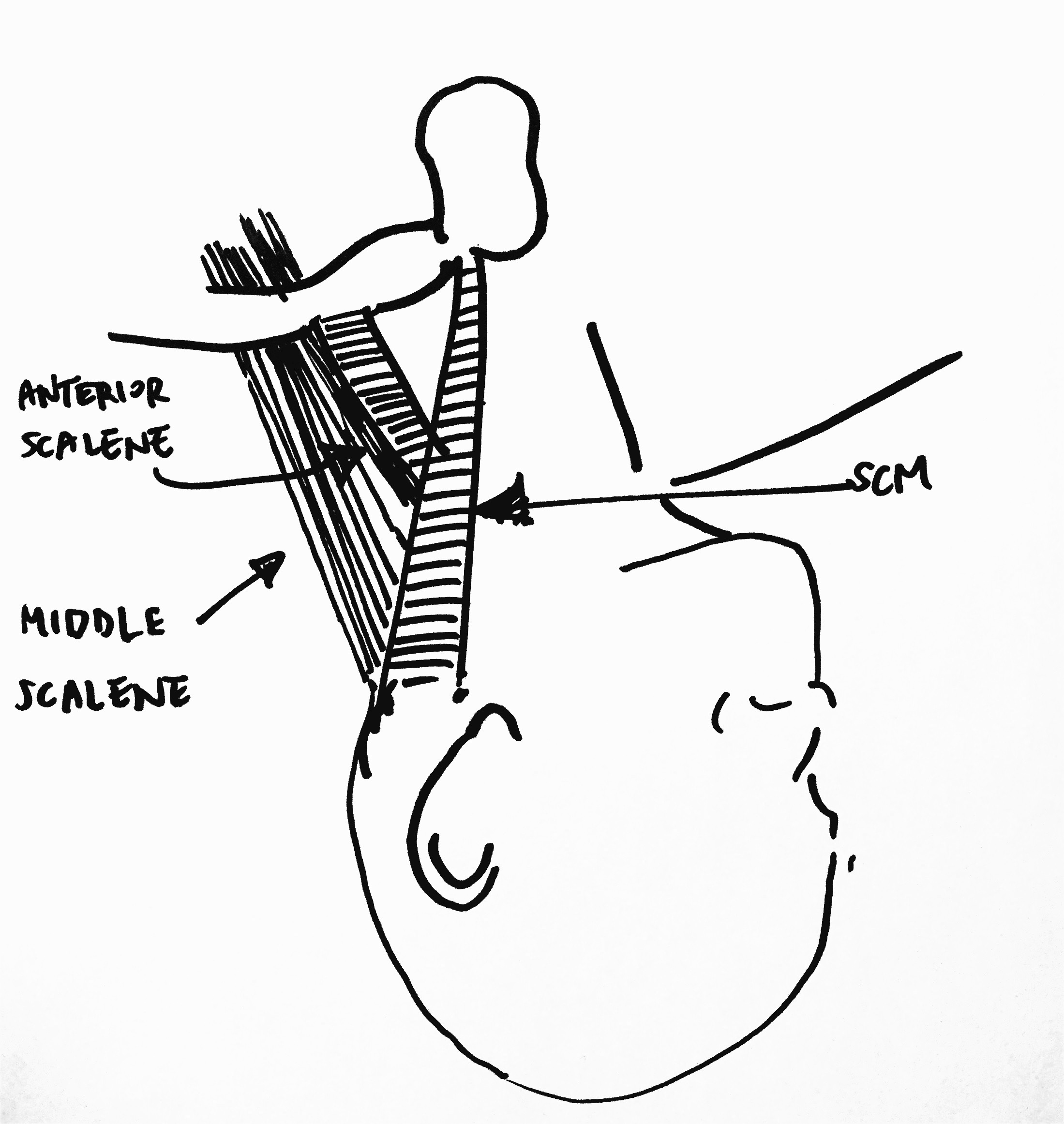 2199x2323 Interscalene Nerve Block Knockout That Upper Extremity Sinaiem