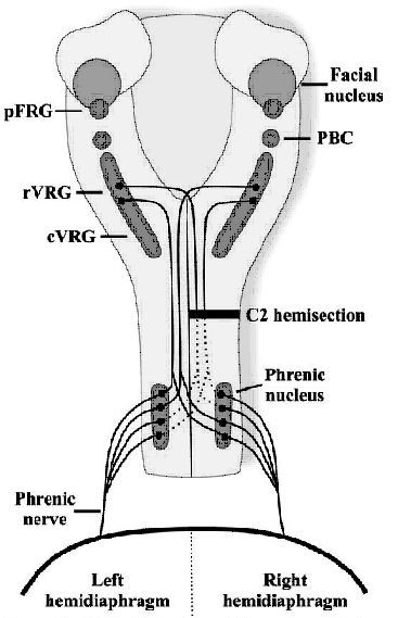 367x569 Phrenic Nerve Pacing Current Concepts Intechopen