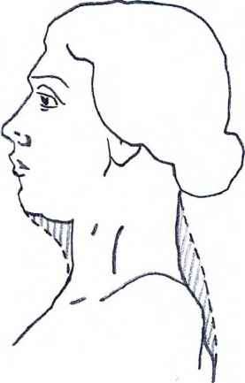 277x433 Obese Figures