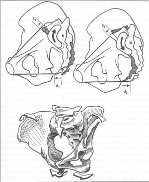300x365 Straight Talk About Movement In The Skillful Teaching