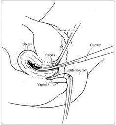 236x254 Pituitary Gland Problems A Special Report