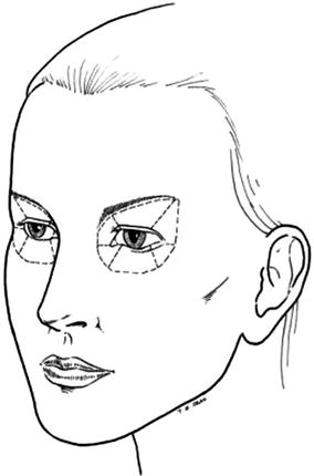 284x430 Eyelids Plastic Surgery Key