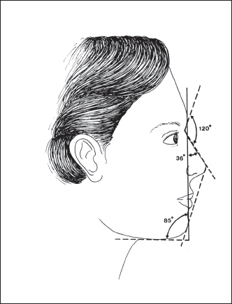 332x435 Facial Proportions And Aesthetic Ideals In Rhinoplasty Plastic