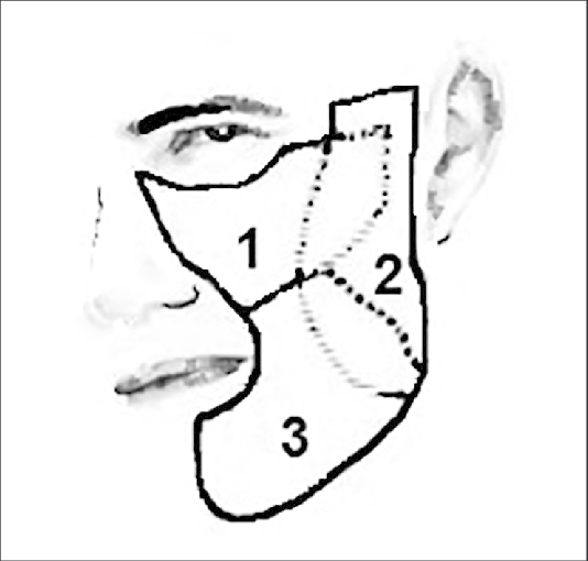 534x510 Aesthetic Cheek Zones According To Mathez Textbook Of Plastic