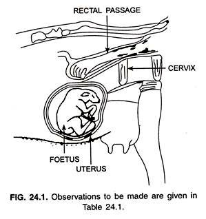 Pregnancy Test Drawing at GetDrawings | Free download