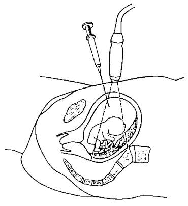 Pregnancy Test Drawing at GetDrawings | Free download