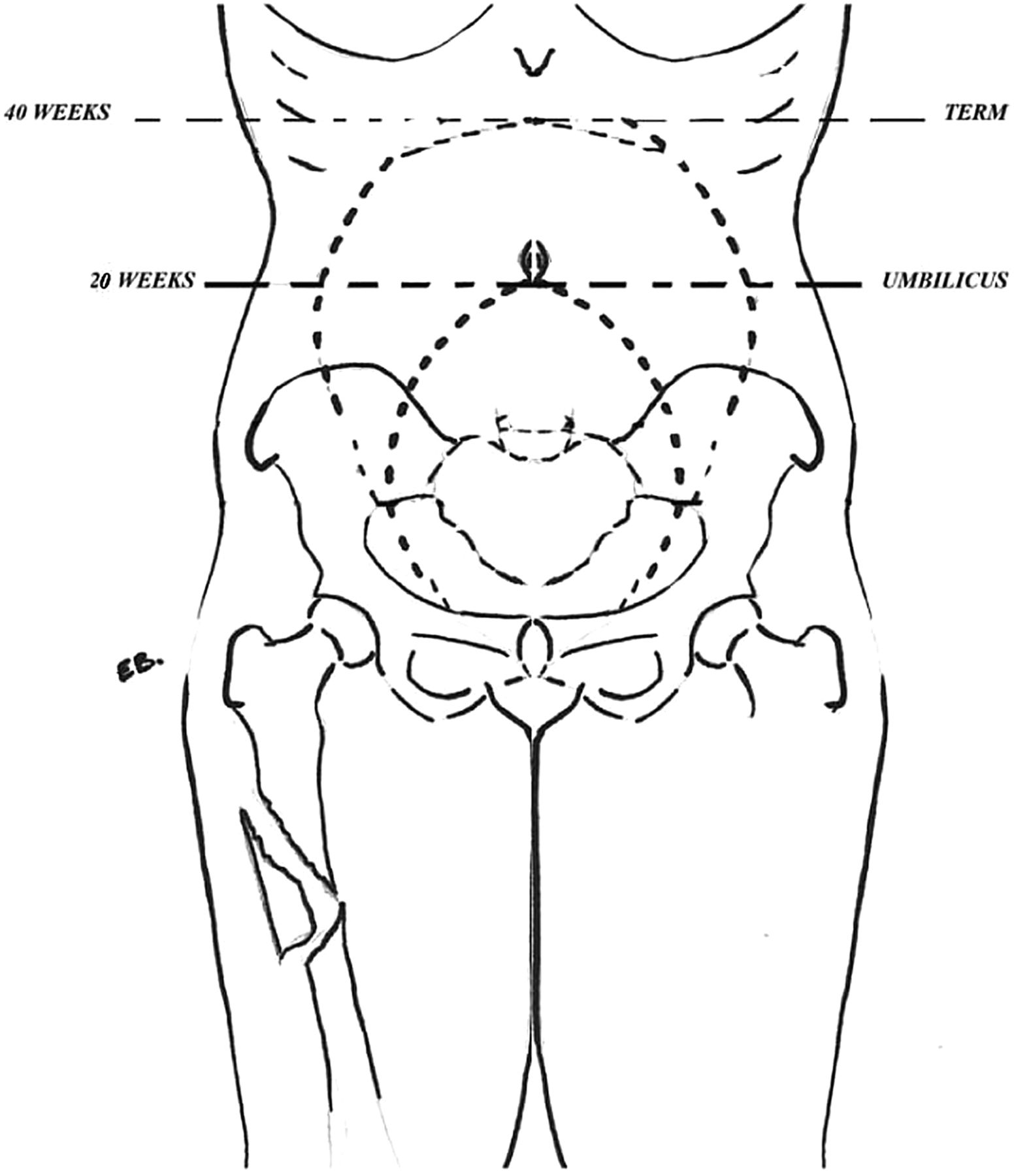 1552x1800 Management Of Pregnancy And Obstetric Complications In Prehospital