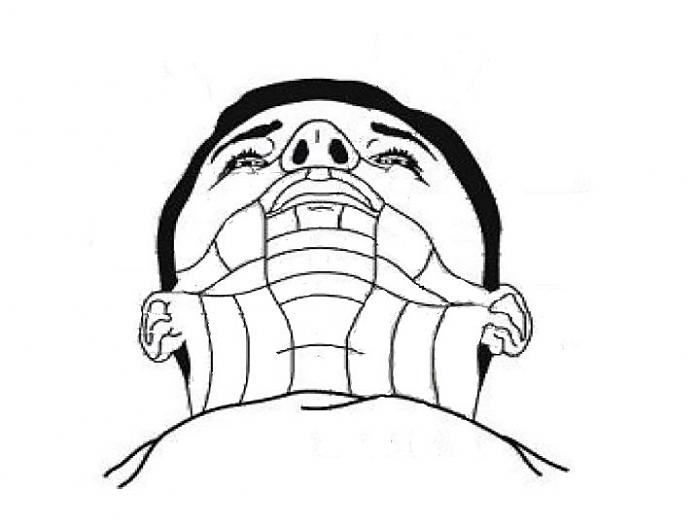 700x527 Facial Mapping