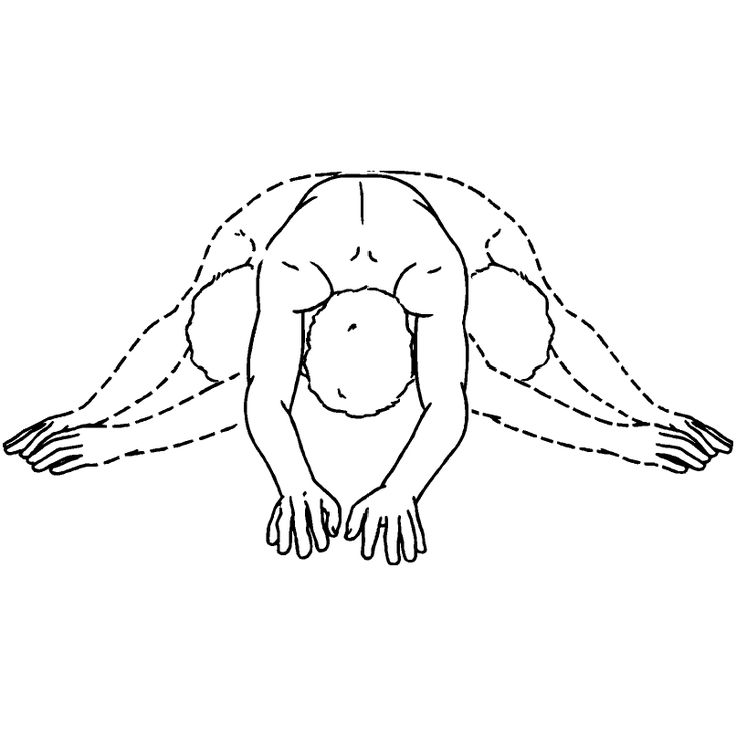 736x736 42 Best Scoliosis Treatment Images On Scoliosis