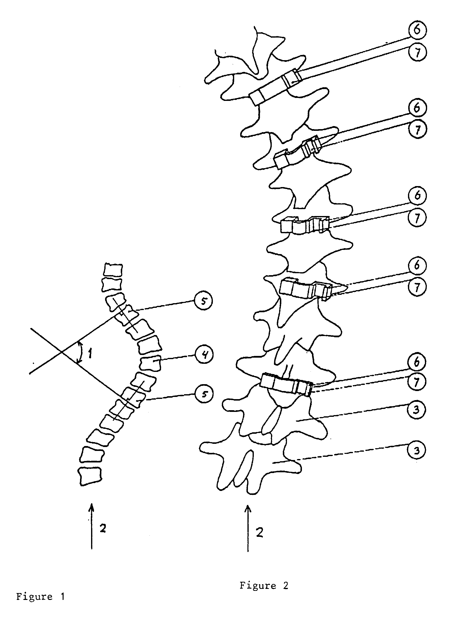 1878x2538 Patent Ep0470660b1