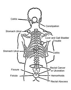 236x300 Pictures Of Scoliosis Muscles Scoliosis Anatomy