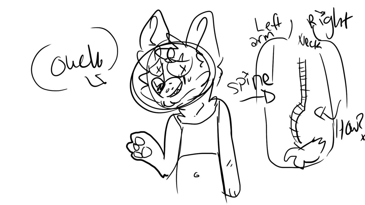 1191x670 Spina Bifida And Scoliosis By Catantlerzz