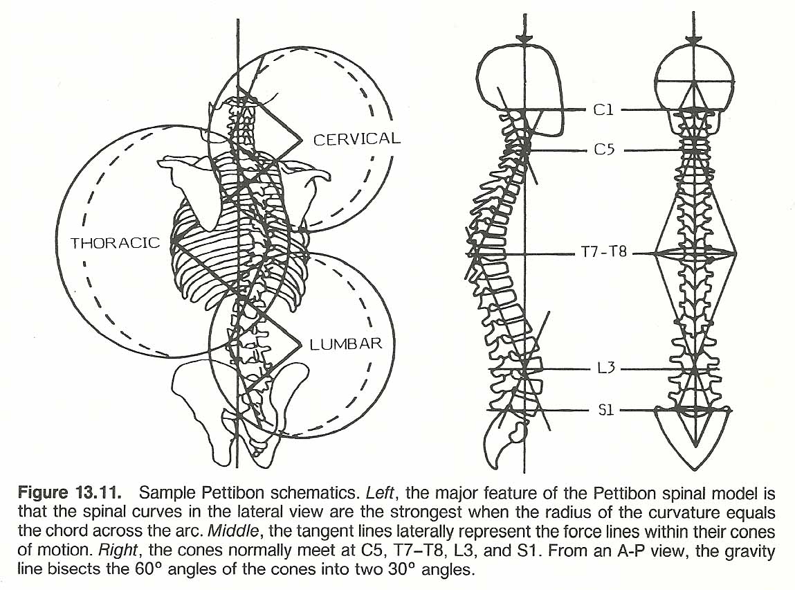 1149x852 Chapter 13 Scoliosis