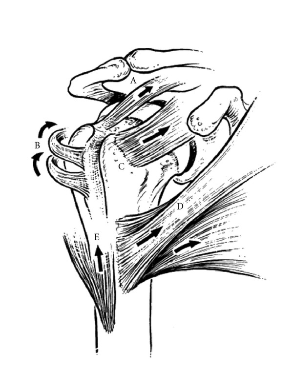 600x766 This Drawing Demonstrates The Deforming Forces On The Proximal