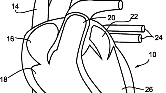 570x320 Simple Drawing Of Circulatory System My Heart Is Set On You. Free