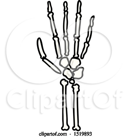 450x470 Cartoon Of A Cut Off Hand