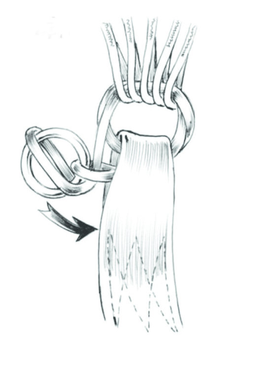 550x748 Aerodyne Soft Links