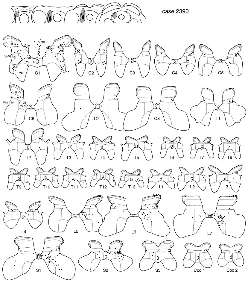 829x945 Schematic Drawings Of The Labeled Neurons In The Spinal