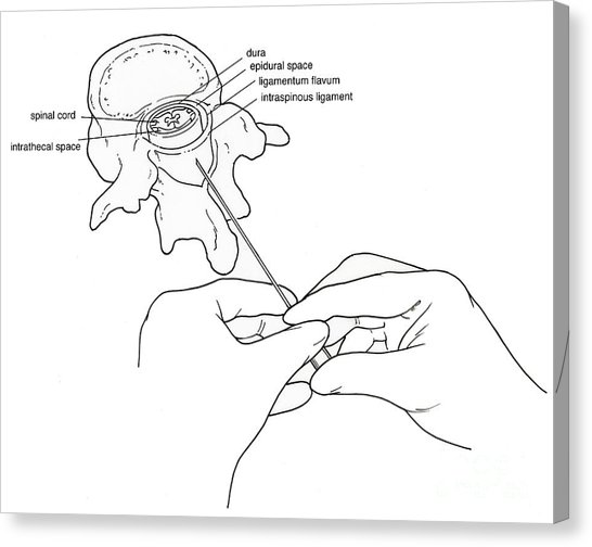 546x504 Spinal Cord Canvas Prints