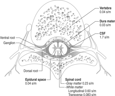 395x332 Spinal Cord Stimulation For Chronic Pain Management Implantation