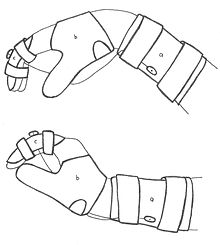 220x245 Userjackson Pampoc6 Spinal Cord Injury