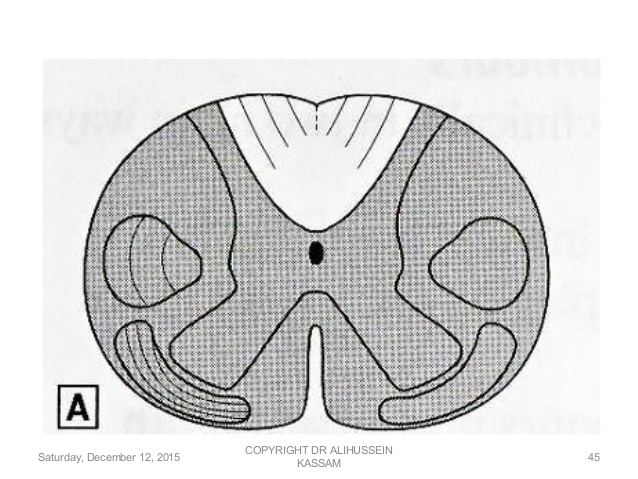 Spinal Cord Drawing at GetDrawings | Free download