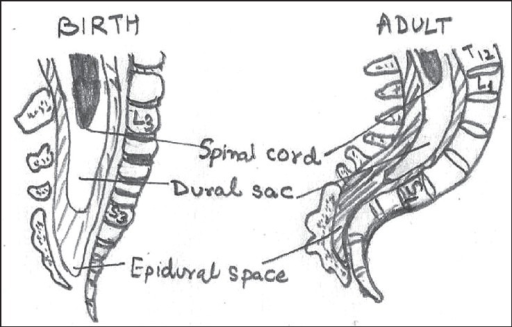 512x327 Anatomical Differences Between Pediatric And Adult Spin Open I