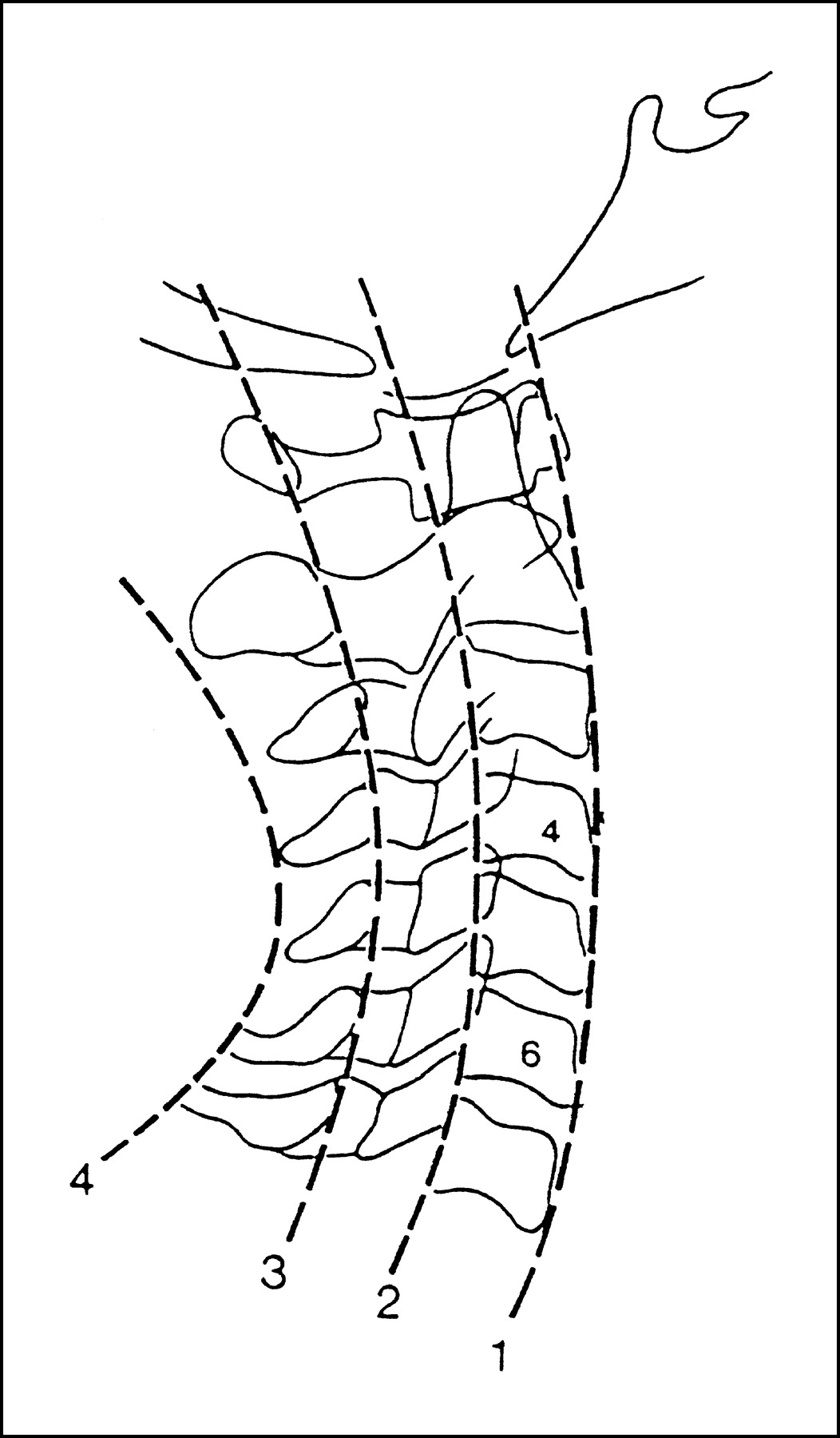 1052x1800 Pediatric Neck Injuries Articles Pediatrics In Review